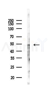 ZBTB12 Antibody - Western blot analysis of lysates from HepG2 cells(LPS,4h treatment), using ZBTB12 Antibody at 1/1000 dilution.