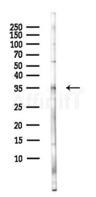 PDLIM4 Antibody - Western blot analysis of lysates from Hela cells(heat-shock,45min treatment), using PDLIM4 Antibody at 1/1000 dilution.