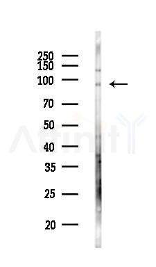 TMEM63C Antibody - Western blot analysis of lysates from HepG2 cells(LPS,4h treatment), using TMEM63C Antibody at 1/1000 dilution.