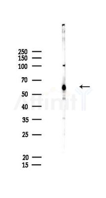 DMRT2 Antibody - Western blot analysis of lysates from HepG2 cells(LPS,4h treatment), using DMRT2 Antibody at 1/1000 dilution.