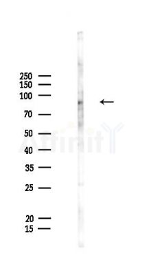 LRIF1 Antibody - Western blot analysis of lysates from HepG2 cells(LPS,4h treatment), using LRIF1 Antibody at 1/1000 dilution.