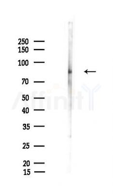 LRIF1 Antibody - Western blot analysis of lysates from LoVo cells(heat-shock,45min treatment), using LRIF1 Antibody at 1/1000 dilution.