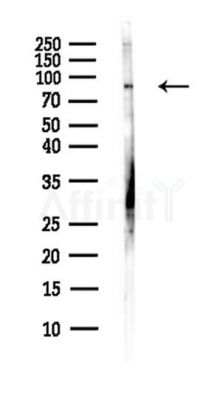 PLEKHG6 Antibody - Western blot analysis of lysates from B16F10-LUC cells(starvation,24h treatment), using PLEKHG6 Antibody at 1/1000 dilution.