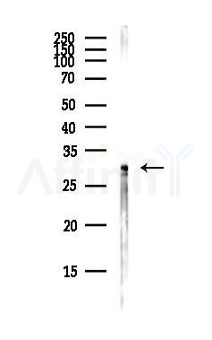 RWDD3 Antibody - Western blot analysis of lysates from Hela cells(heat-shock,45min treatment), using RWDD3 Antibody at 1/1000 dilution.