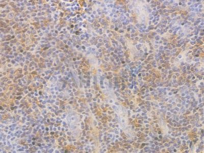 INSM2 Antibody - DF16017 at 1/100 staining human normal tonsil tissue by IHC-P.