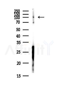 GAREM2 Antibody - Western blot analysis of lysates from Hela cells(heat-shock,45min treatment), using GAREM2 Antibody at 1/1000 dilution.