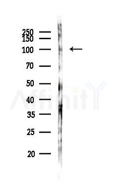 ESPN Antibody - Western blot analysis of lysates from Mouse brain, using ESPN Antibody at 1/1000 dilution.
