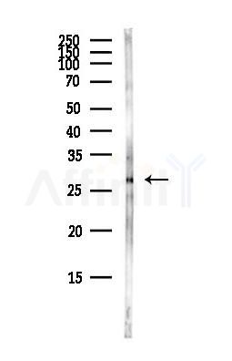 MDFIC Antibody - Western blot analysis of lysates from Hela cells(heat-shock,45min treatment), using MDFIC Antibody at 1/1000 dilution.