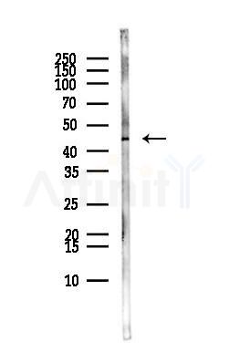 COQ3 Antibody - Western blot analysis of lysates from MCF7 cells(heat-shock,45min treatment), using COQ3 Antibody at 1/1000 dilution.
