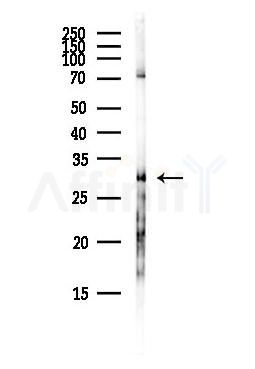 OSCAR Antibody - Western blot analysis of lysates from Hela cells(heat-shock,45min treatment), using OSCAR Antibody at 1/1000 dilution.