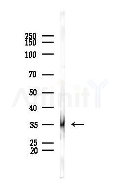 OSCAR Antibody - Western blot analysis of lysates from PC12 cells, using OSCAR Antibody at 1/1000 dilution.