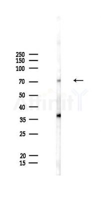 PRDM8 Antibody - Western blot analysis of lysates from HepG2 cells(LPS,4h treatment), using PRDM8 Antibody at 1/1000 dilution.