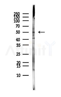 MINDY1 Antibody - Western blot analysis of lysates from MCF7 cells(heat-shock,45min treatment), using MINDY1 Antibody at 1/1000 dilution.