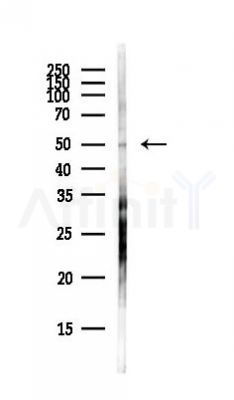 MINDY1 Antibody - Western blot analysis of lysates from Hela cells(heat-shock,45min treatment), using MINDY1 Antibody at 1/1000 dilution.