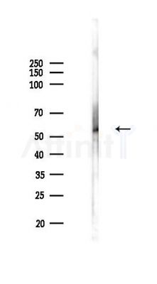 ABHD15 Antibody - Western blot analysis of lysates from HepG2 cells(LPS,4h treatment), using ABHD15 Antibody at 1/1000 dilution.
