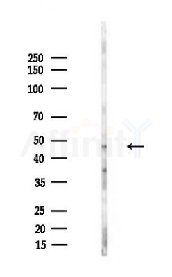 ABHD15 Antibody - Western blot analysis of lysates from LoVo cells(heat-shock,45min treatment), using ABHD15 Antibody at 1/1000 dilution.