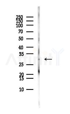 LRRC3B Antibody - Western blot analysis of lysates from MCF7 cells(heat-shock,45min treatment), using LRRC3B Antibody at 1/1000 dilution.