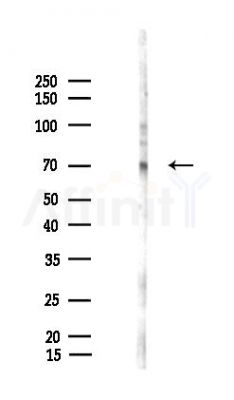 LRRTM4 Antibody - Western blot analysis of lysates from LoVo cells(heat-shock,45min treatment), using LRRTM4 Antibody at 1/1000 dilution.