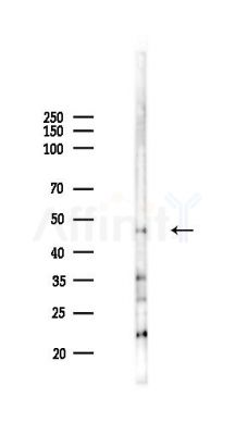 LARP6 Antibody - Western blot analysis of lysates from HepG2 cells(LPS,4h treatment), using LARP6 Antibody at 1/1000 dilution.