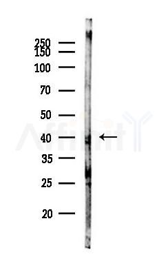 TRMT10C Antibody - Western blot analysis of lysates from Hela cells(heat-shock,45min treatment), using TRMT10C Antibody at 1/1000 dilution.