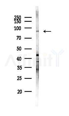 TPCN1 Antibody - Western blot analysis of lysates from Mouse brain, using TPCN1 Antibody at 1/1000 dilution.