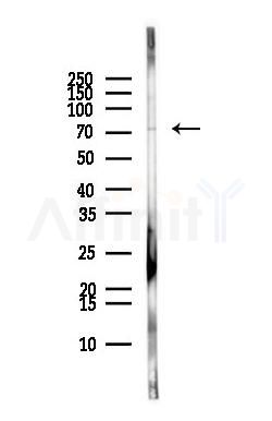 ZNF233 Antibody - Western blot analysis of lysates from MCF7 cells(heat-shock,45min treatment), using ZNF233 Antibody at 1/1000 dilution.