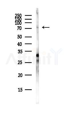 ZNF233 Antibody - Western blot analysis of lysates from Hela cells(heat-shock,45min treatment), using ZNF233 Antibody at 1/1000 dilution.