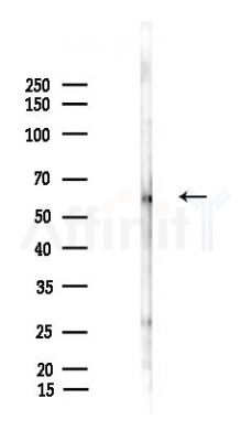 ZNF530 Antibody - Western blot analysis of lysates from LoVo cells(heat-shock,45min treatment), using ZNF530 Antibody at 1/1000 dilution.