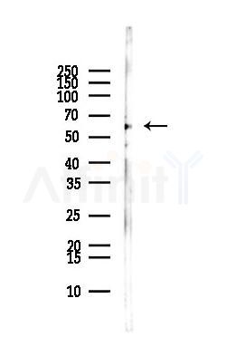 ZNF248 Antibody - Western blot analysis of lysates from MCF7 cells(heat-shock,45min treatment), using ZNF248 Antibody at 1/1000 dilution.