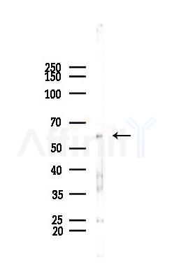 ZNF248 Antibody - Western blot analysis of lysates from PC12 cells, using ZNF248 Antibody at 1/1000 dilution.