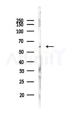 ZNF468 Antibody - Western blot analysis of lysates from Mouse brain, using ZNF468 Antibody at 1/1000 dilution.