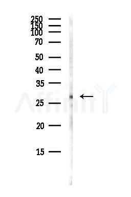 FAM167A Antibody - Western blot analysis of lysates from Hela cells(heat-shock,45min treatment), using FAM167A Antibody at 1/1000 dilution.