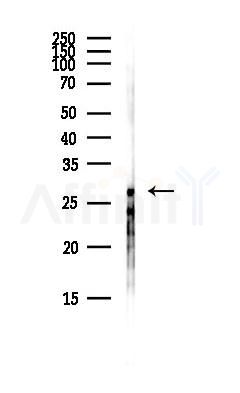 CLRN3 Antibody - Western blot analysis of lysates from Hela cells(heat-shock,45min treatment), using CLRN3 Antibody at 1/1000 dilution.
