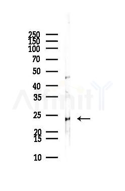 UROS Antibody - Western blot analysis of lysates from MCF7 cells(heat-shock,45min treatment), using UROS Antibody at 1/1000 dilution.