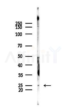 UROS Antibody - Western blot analysis of lysates from PC12 cells, using UROS Antibody at 1/1000 dilution.