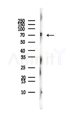 ANKRD13C Antibody - Western blot analysis of lysates from MCF7 cells(heat-shock,45min treatment), using ANKRD13C Antibody at 1/1000 dilution.