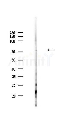 TDRD3 Antibody - Western blot analysis of lysates from HepG2 cells(LPS,4h treatment), using TDRD3 Antibody at 1/1000 dilution.