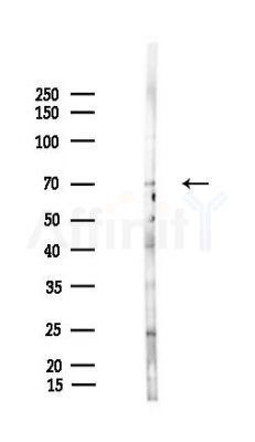 TDRD3 Antibody - Western blot analysis of lysates from LoVo cells(heat-shock,45min treatment), using TDRD3 Antibody at 1/1000 dilution.
