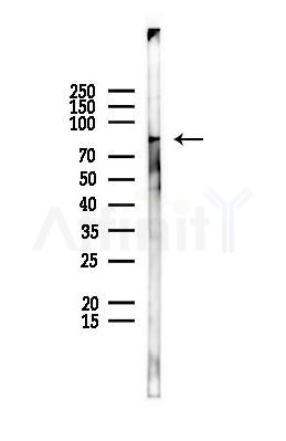 DDX3Y Antibody - Western blot analysis of lysates from EC304 cells(UV,30min treatment), using DDX3Y Antibody at 1/1000 dilution.