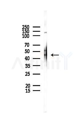 KRR1 Antibody - Western blot analysis of lysates from EC304 cells(UV,30min treatment), using KRR1 Antibody at 1/1000 dilution.