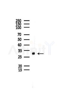PEF1 Antibody - Western blot analysis of lysates from EC304 cells(UV,30min treatment), using PEF1 Antibody at 1/1000 dilution.