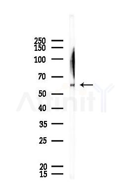 MSTO1 Antibody - Western blot analysis of lysates from A375 cells, using MSTO1 Antibody at 1/1000 dilution.
