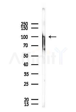 TBCK Antibody - Western blot analysis of lysates from A375 cells, using TBCK Antibody at 1/1000 dilution.