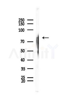 PIGR Antibody - Western blot analysis of lysates from Mouse muscle, using PIGR Antibody at 1/1000 dilution.