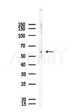 XYLB Antibody - Western blot analysis of lysates from A375 cells, using XYLB Antibody at 1/1000 dilution.