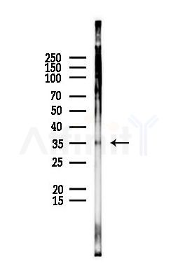 PRPS1L1 Antibody - Western blot analysis of lysates from EC304 cells(UV,30min treatment), using PRPS1L1 Antibody at 1/1000 dilution.