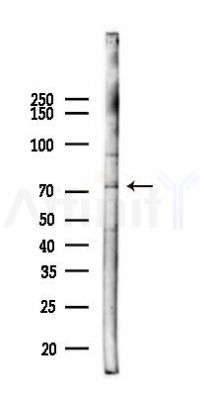 ZNF398 Antibody - Western blot analysis of lysates from LoVo cells(heat-shock,45min treatment), using ZNF398 Antibody at 1/1000 dilution.