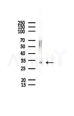 NSL1 Antibody - Western blot analysis of lysates from EC304 cells(UV,30min treatment), using NSL1 Antibody at 1/1000 dilution.