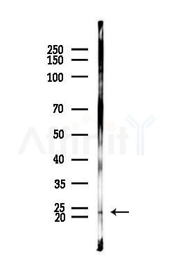 ARL14 Antibody - Western blot analysis of lysates from Mouse muscle, using ARL14 Antibody at 1/1000 dilution.