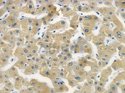 LRRC42 Antibody - DF2207 at 1/100 staining human normal liver tissue by IHC-P.